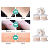 Silicone Scar Gel Tape