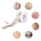 Silicone Scar Gel Tape